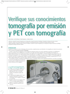 tomografía por emisión de positrones y PET con tomografía