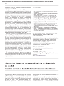 Obstruccio´ n intestinal por enterolitiasis de un divertıculo de Meckel