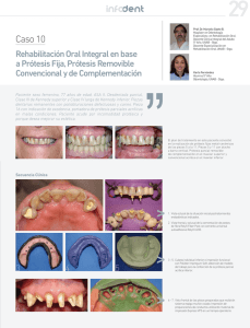 Rehabilitación Oral Integral en base a Prótesis Fija