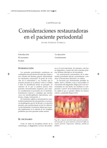 Consideraciones restauradoras en el paciente periodontal