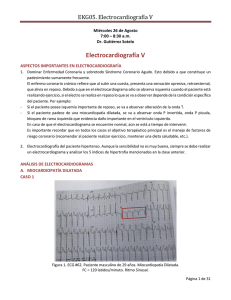 EKG05. Electrocardiografía V