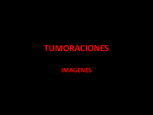 TUMORACIONES (1)
