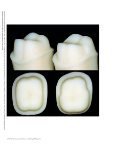 articulo diseños de preparacion para dientes posteriores Edelhoff
