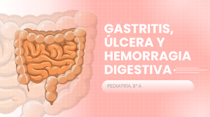Gastitris, úlcera y hemorragia digestiva
