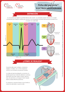 Electrocardiograma