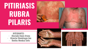 PITIRIASIS RUBRA PILARIS (1)