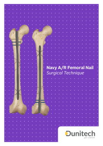 Navy Femoral Nail Surgical Technique