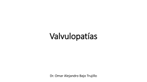 Valvulopatías. 