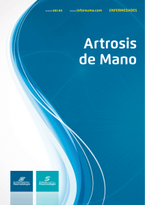 Artrosis De Mano