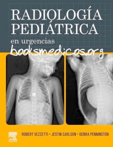 Radiologia Pediatrica en Urgencias