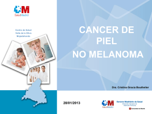 Cáncer de Piel No Melanoma: Tipos, Diagnóstico y Tratamiento