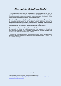 Fibrilación Ventricular: Causas, Mecanismos y Consecuencias