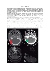 Caso Cl&iacute;nico: Otitis Media Cr&oacute;nica Complicada
