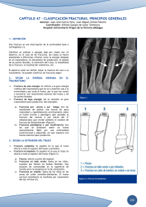 Clasificaci&oacute;n de Fracturas: Principios Generales