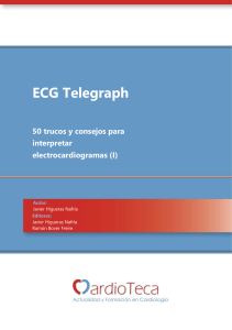 ECG Telegraph: 50 trucos para interpretar electrocardiogramas (I)