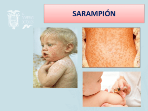 Sarampión: Síntomas, Causas, Tratamiento y Prevención