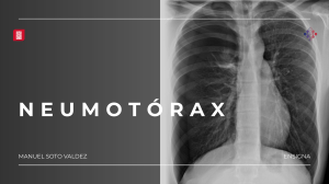 Neumot&oacute;rax: Clasificaci&oacute;n, Diagn&oacute;stico y Tratamiento - Presentaci&oacute;n M&eacute;dica