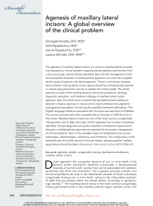 Agenesis of Maxillary Lateral Incisors: Clinical Overview