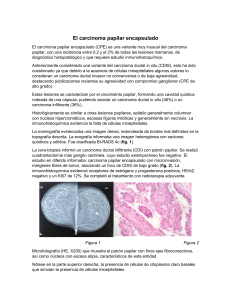 Carcinoma Papilar Encapsulado: Diagn&oacute;stico y Tratamiento