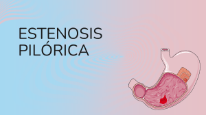Estenosis Pil&oacute;rica: Concepto, Diagn&oacute;stico y Tratamiento