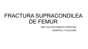 Fractura Supracond&iacute;lea de F&eacute;mur: Presentaci&oacute;n Cl&iacute;nica